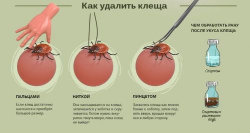 Як витягнути кліща